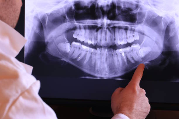 Best Tooth Pain Emergency Relief  in Gulf Hills, MS